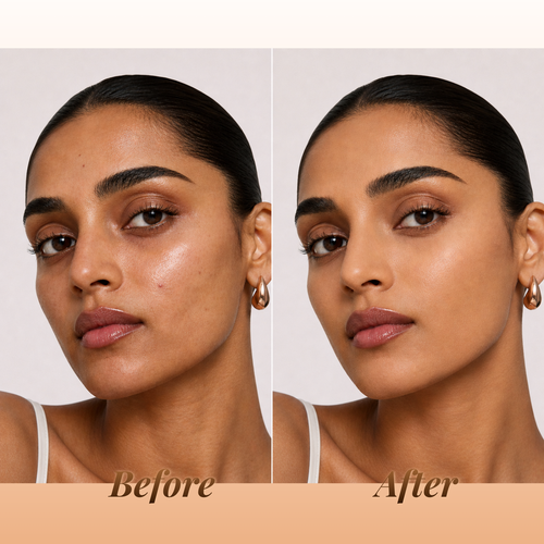 Before and after comparison of a woman's face with visible skin improvement.