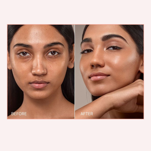 Before and after comparison of a woman's face with visible skin improvement.