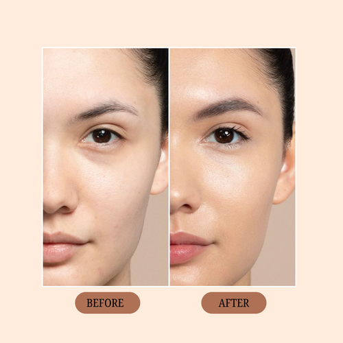 Before and after comparison of a woman's face with visible skin improvement.