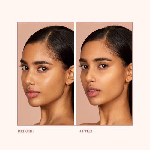Before and after comparison of a woman's face on a beige background