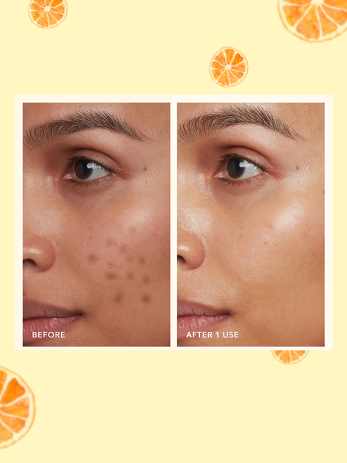 Lakyou Beauty - Vitamin C Face Serum | Brightening Anti-Dark Spot Radiance Serum