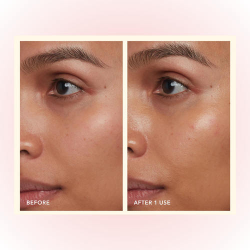 Before and after comparison of a skincare product on a person's face with a pink background.