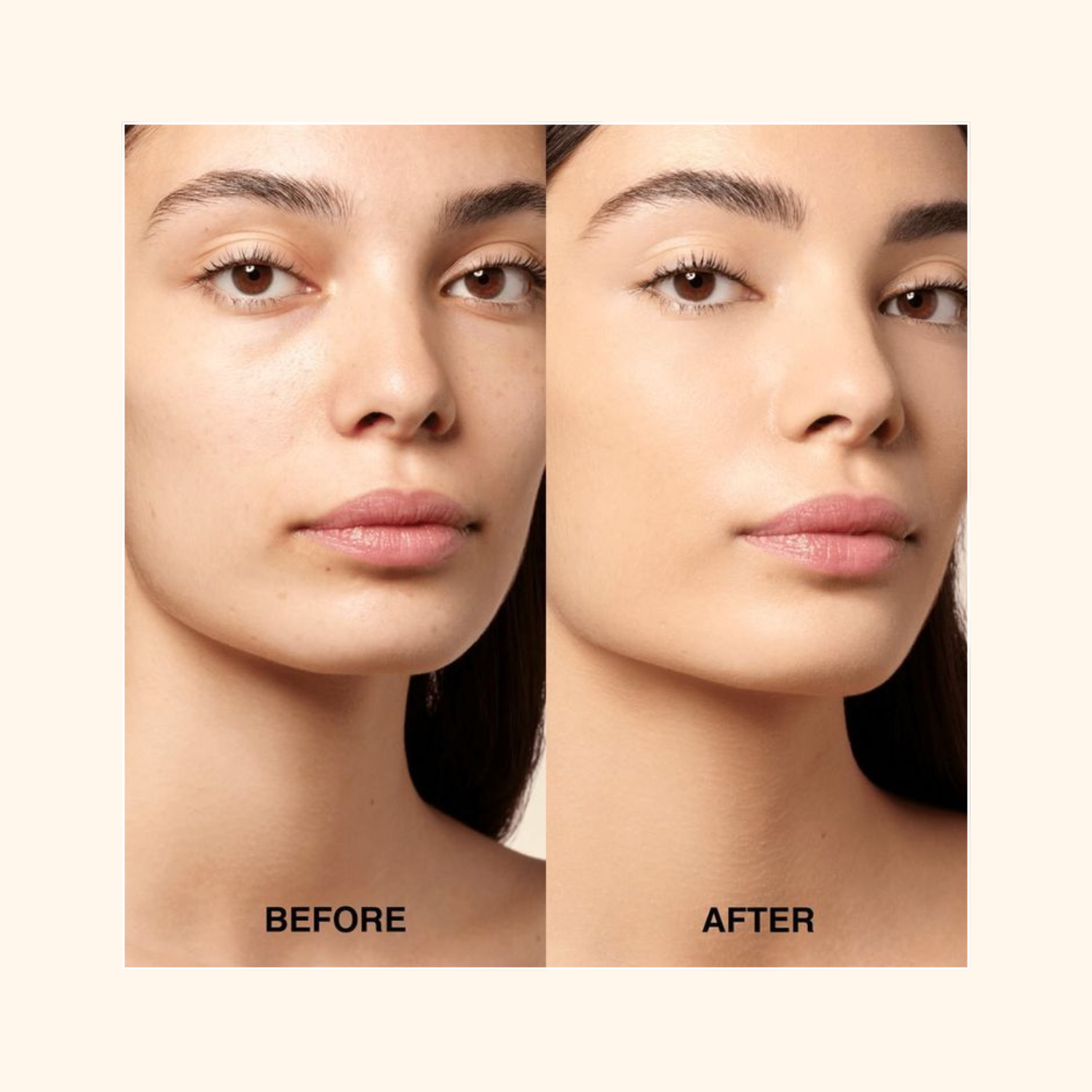 Before and after comparison of a woman's face with 'Before' on the left and 'After' on the right.