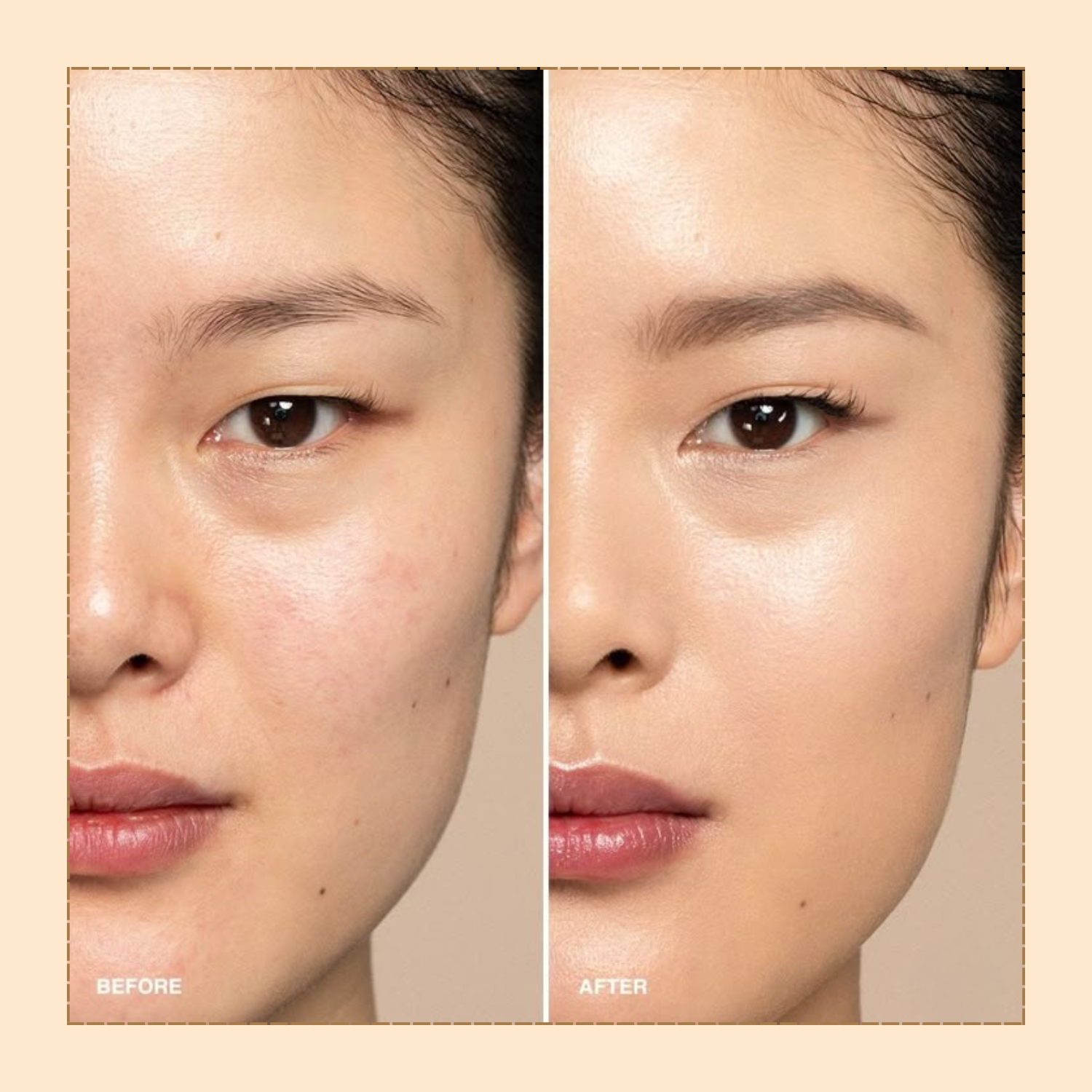 Lakyou Beauty - Concealer Palette | Full Coverage Color Correcting Concealer Kit