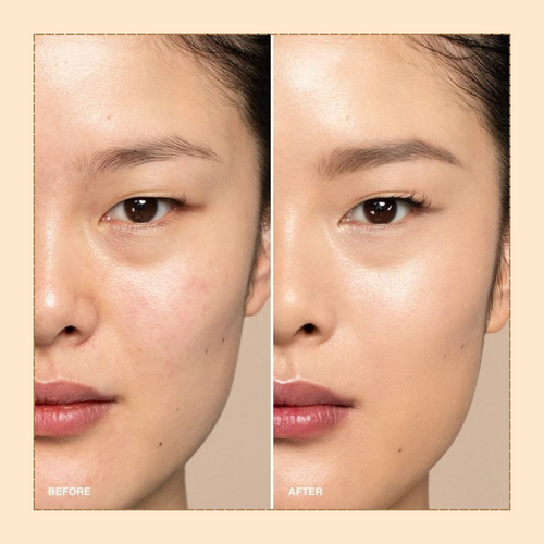 Lakyou Beauty - Concealer Palette | Full Coverage Color Correcting Concealer Kit