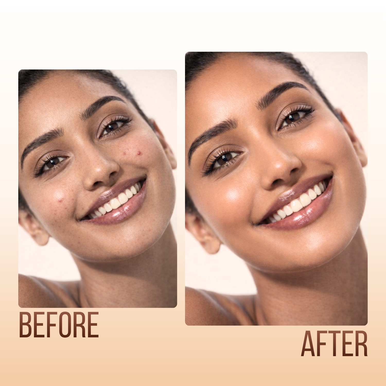 Before and after comparison of a woman's face with skin treatment effects.