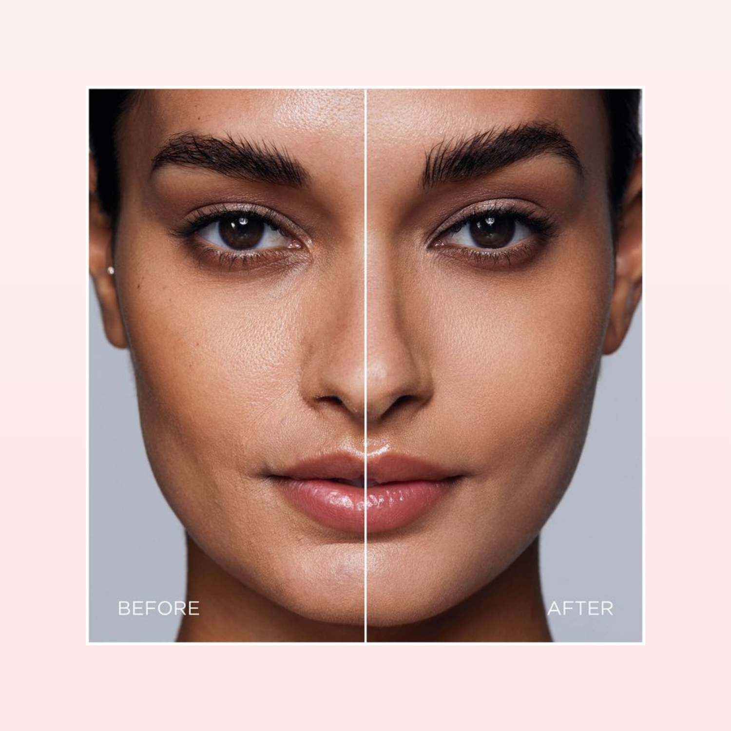Before and after comparison of a woman's face with skin treatment effects.